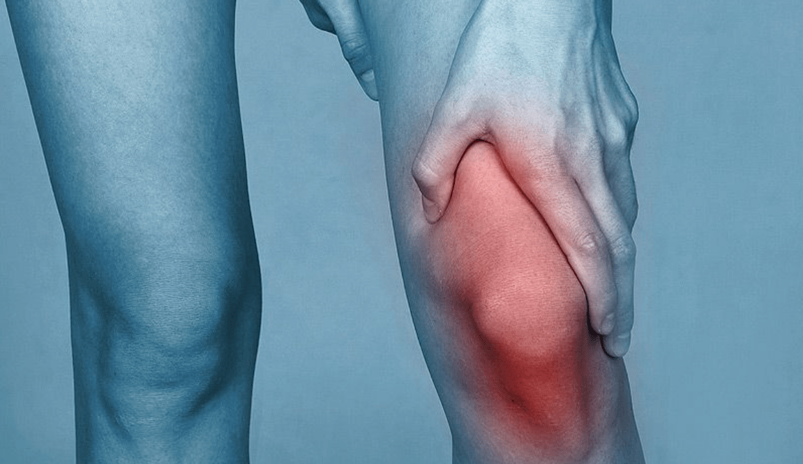 Schmerzen im Kniegelenk aufgrund von Arthrose