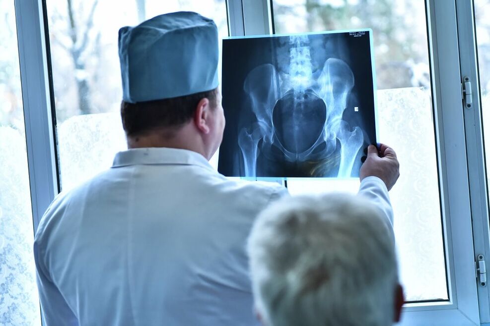 Der Arzt betrachtet ein Bild eines Hüftgelenks mit Arthrose